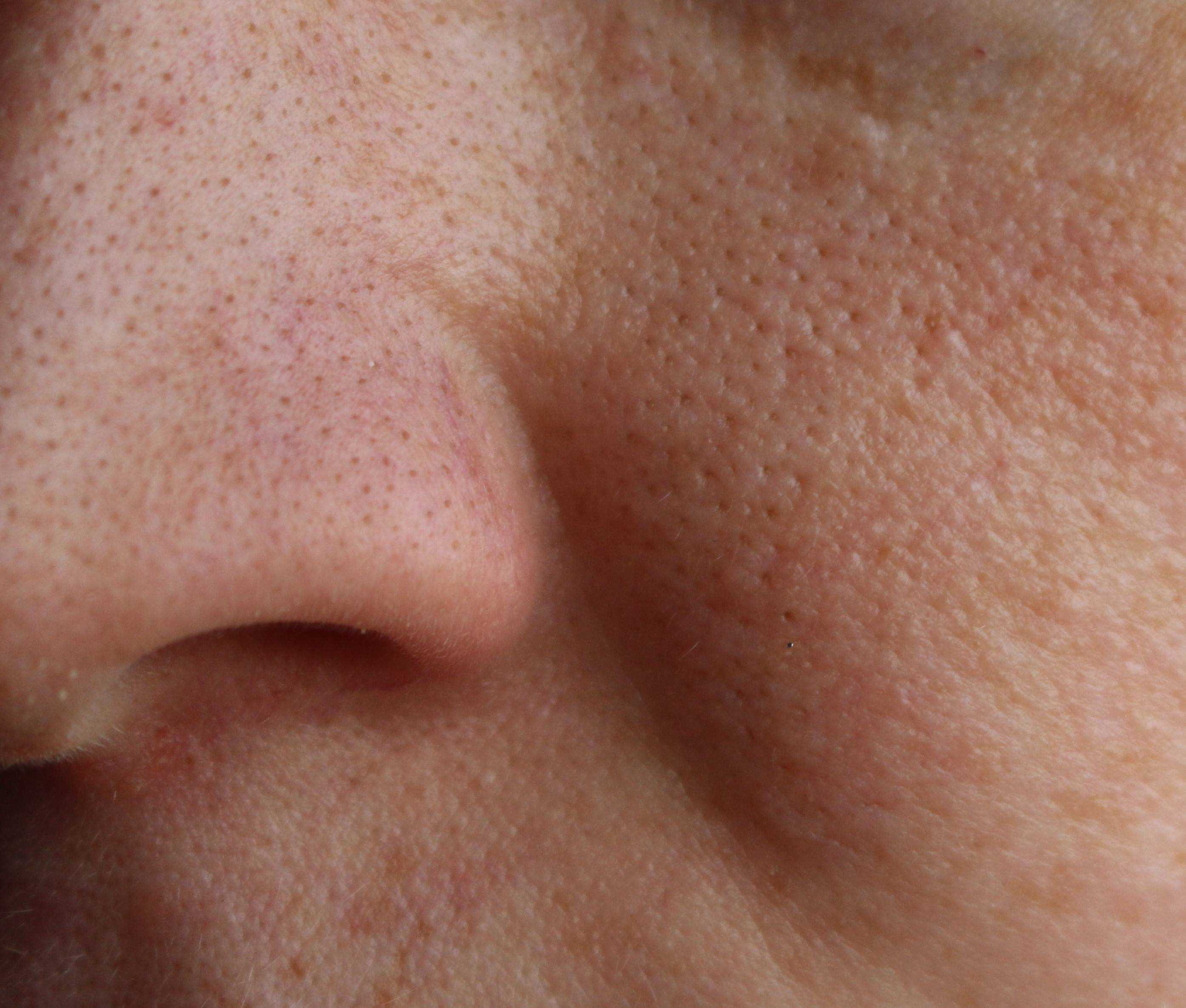 Trypophobia test image 5